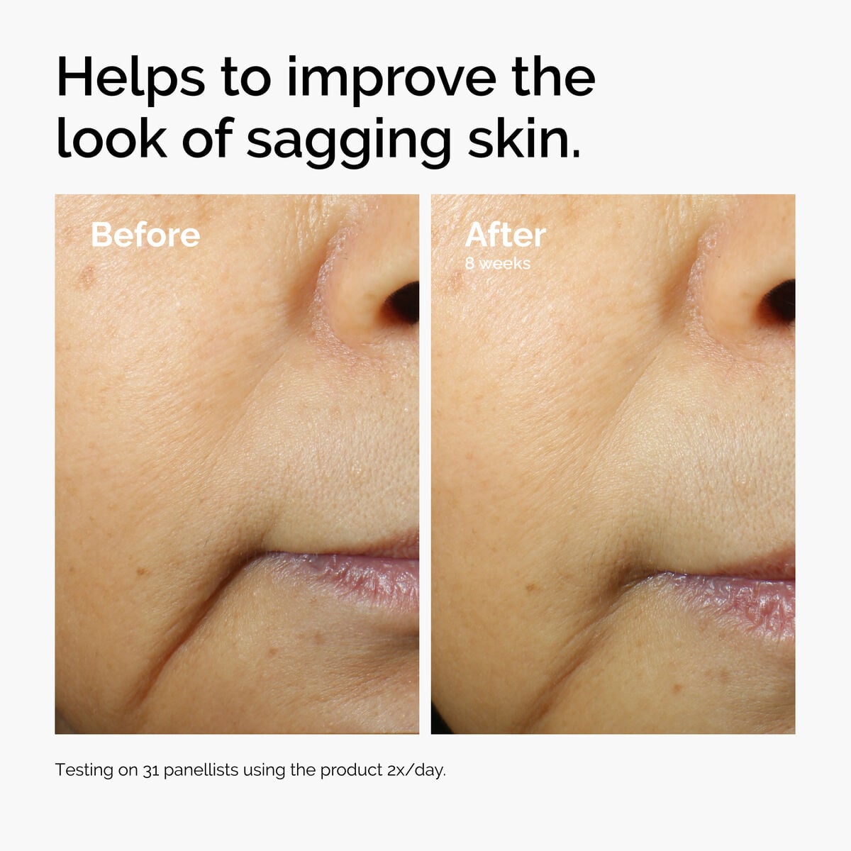 caffeine-3-escin-1-face-serum-h0 ord-caffeine-3pct-escin-1pct-face-serum-before-after-sagging.jpg