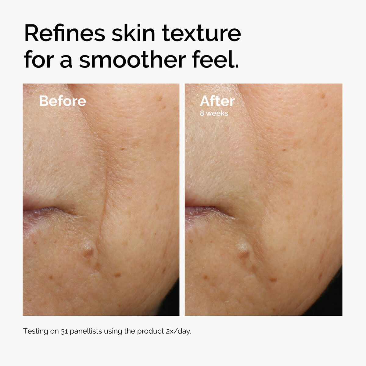 caffeine-3-escin-1-face-serum-h0 ord-caffeine-3pct-escin-1pct-face-serum-before-after-texture.jpg