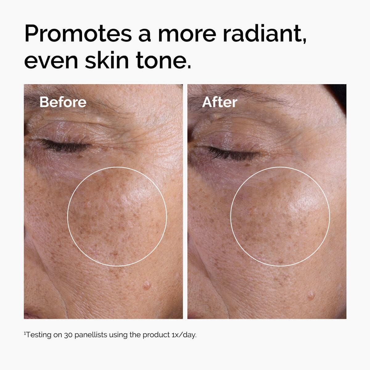 glycolic-acid-7-exfoliating-toner-p2 ord-glycolic-before-after-radiance.jpg