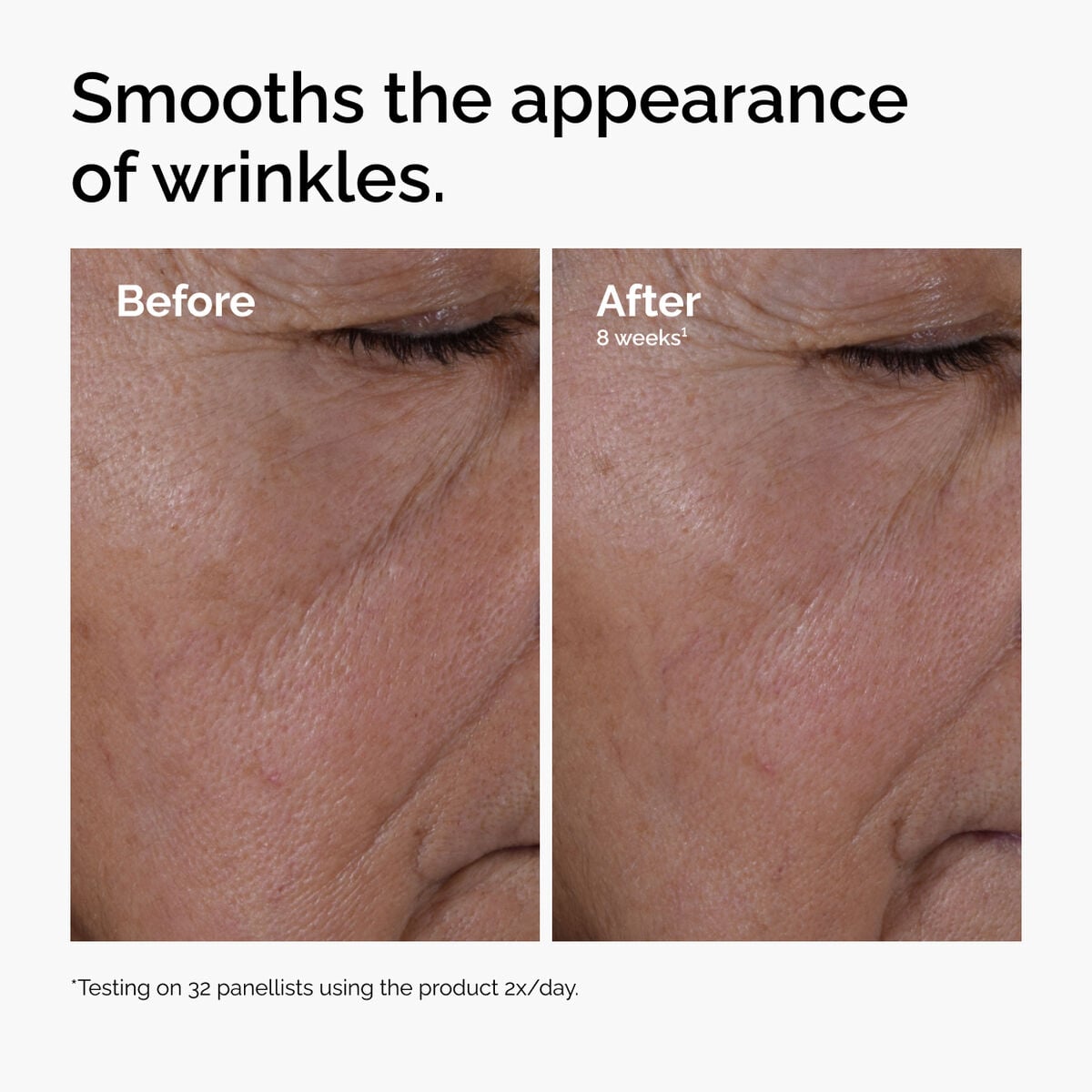 multi-peptide-ha-serum-r3 ord-multi-peptide-ha-serum-wrinkles-before-after.jpg