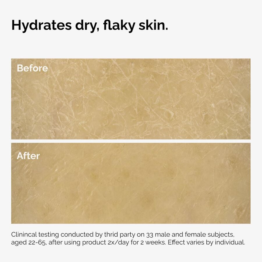 the-body-care-collection-i3 ord-natural-moisturizing-factors-inulin-body-before-after-graphic-02.jpg