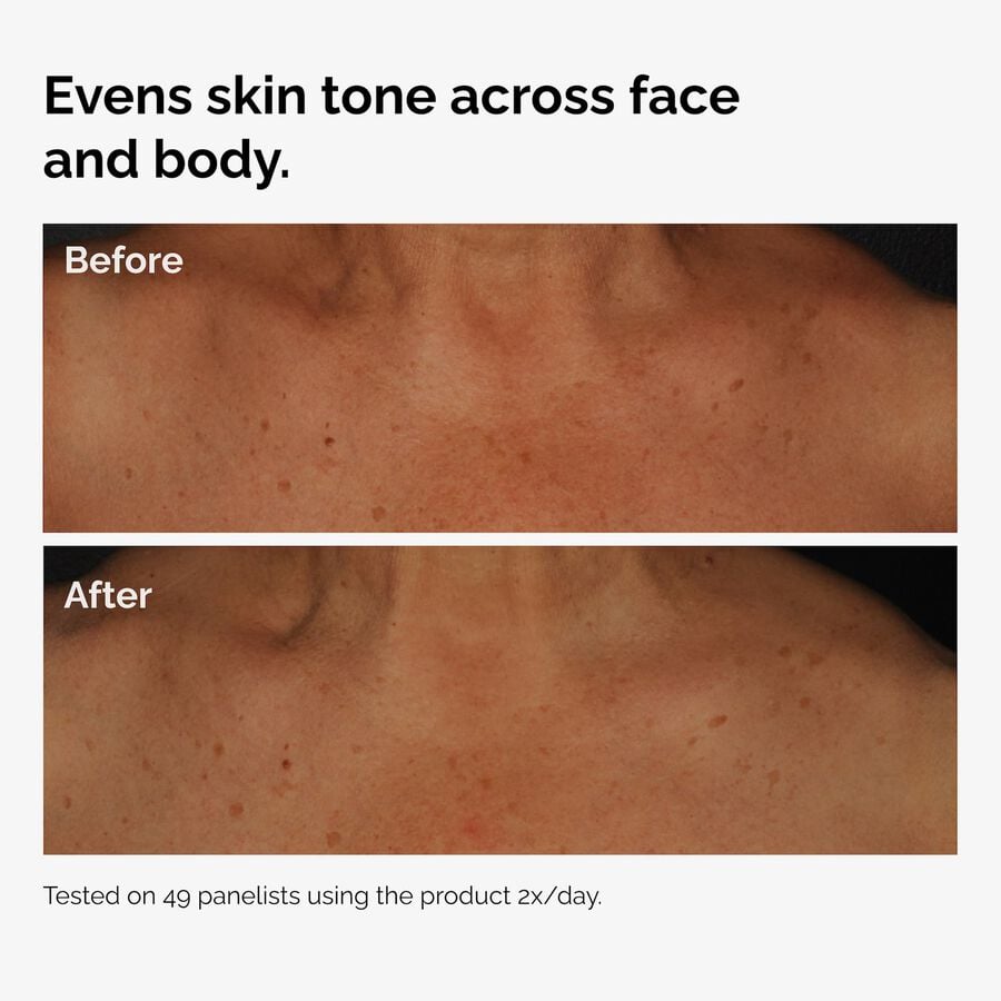 the-body-care-collection-i3 ord-niacinamide-face-body-serum-before-after-even-tone-graphic.jpg