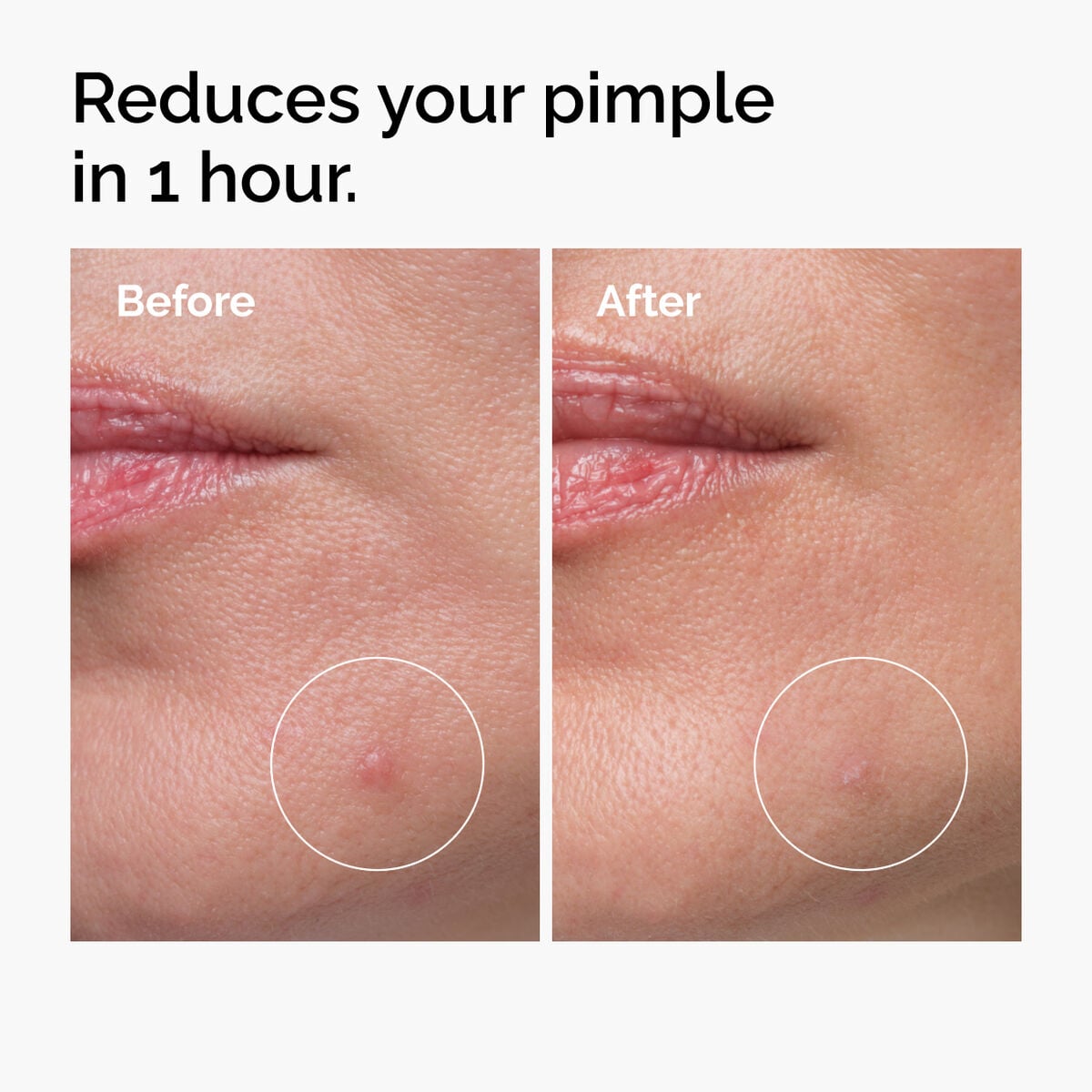 sulfur-10-powder-to-cream-concentrate-e2 ord-sulfur-10pct-powder-to-cream-concentrate-before-after-NA.jpg